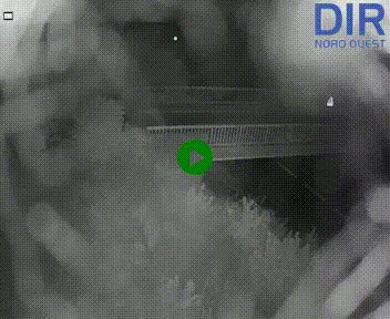 Webcam sur A84 à hauteur de Pont-Farcy, au niveau du pont autoroutier sur la Vire, au sud de Saint-Lô