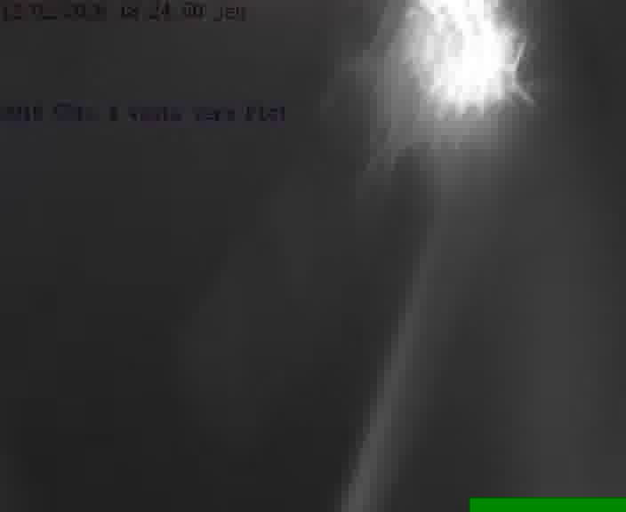 <h2>Webcam sur la D910 située dans la Côte des 4 vents. Vue orientée vers le haut de la côte, vers Faulquemont</h2>