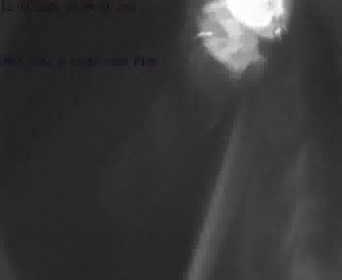 Webcam sur la D910 située dans la Côte des 4 vents. Vue orientée vers le haut de la côte, vers Faulquemont