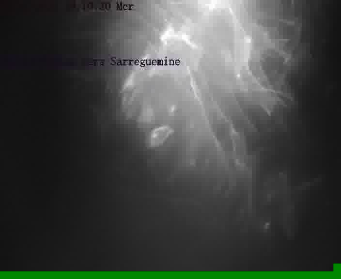 <h2>Webcam installée le long de D31bis (France) à Oeting, pointée vers Sarreguemines, utile pour suivre précisément les conditions de trafic.</h2>